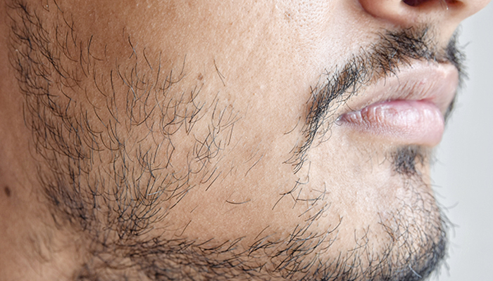 How To Say Goodbye to a Patchy Beard | Man Cave Sydney